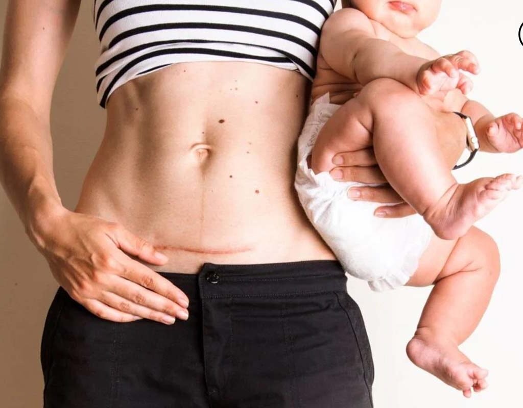 7 Best Reasons : Does Pregnancy Changes Everything For A Woman? | CIO Women Magazine