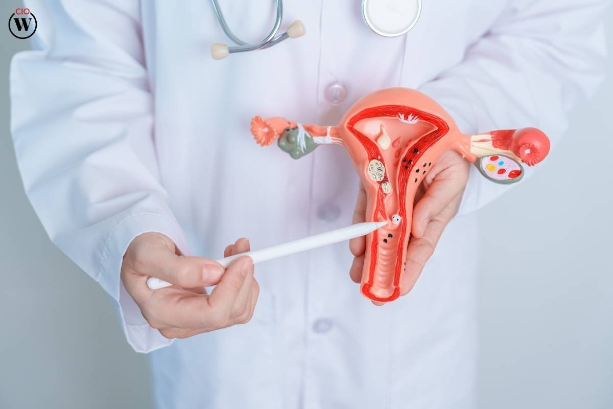Managing PCOS: A Comprehensive Guide to Taking Control of Polycystic Ovary Syndrome | CIO Women Magazine