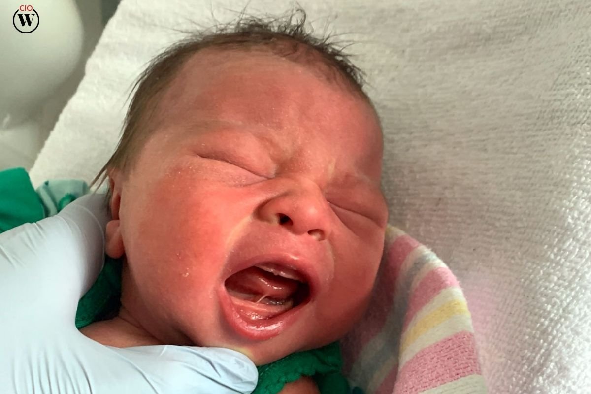 How to Stop Newborn Hiccups? Comprehensive Guide for New Parents | CIO Women Magazine