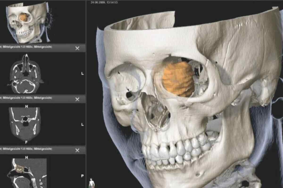 Top 10 Radiology Tech Softwares Revolutionizing Medical Imaging | CIO Women Magazine